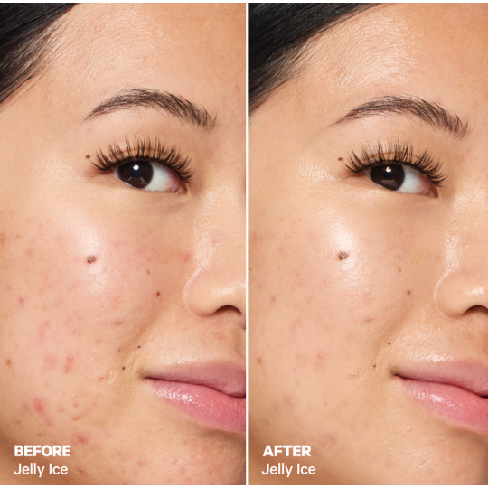 MILK MAKEUP Cooling Water Jelly Ice - Serum apaisant et rafraîchissant à la niacinamide