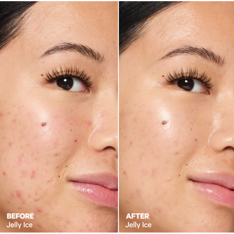 MILK MAKEUP Cooling Water Jelly Ice - Serum apaisant et rafraîchissant à la niacinamide