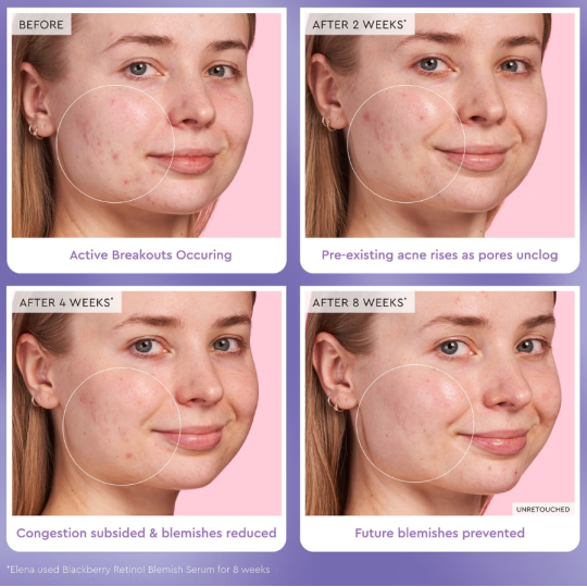 Glow Recipe Blackberry Retinol Blemish Serum 30ml