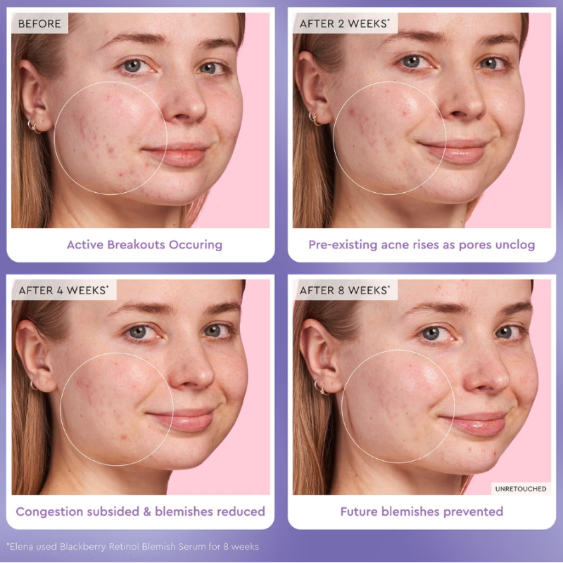 Glow Recipe Blackberry Retinol Blemish Serum 30ml