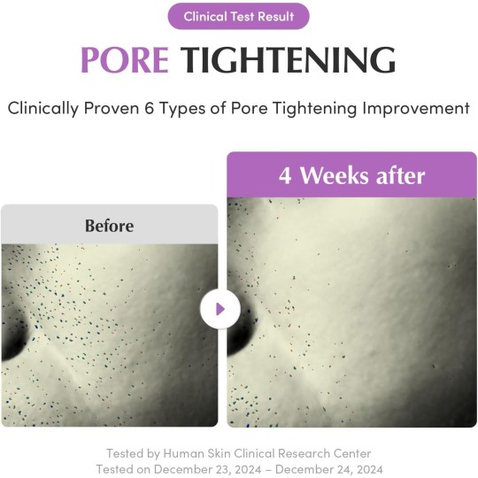 EQQUALBERRY Sérum réducteur de pores Purple PDRN