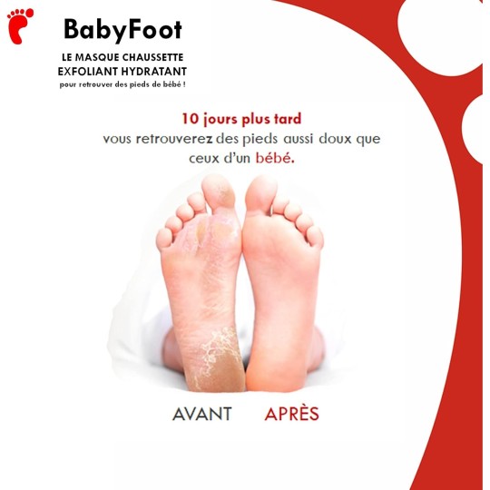 BABY FOOT 1 Paire Masque Chaussette Exfoliant Pieds Anti callosités & Peaux Mortes